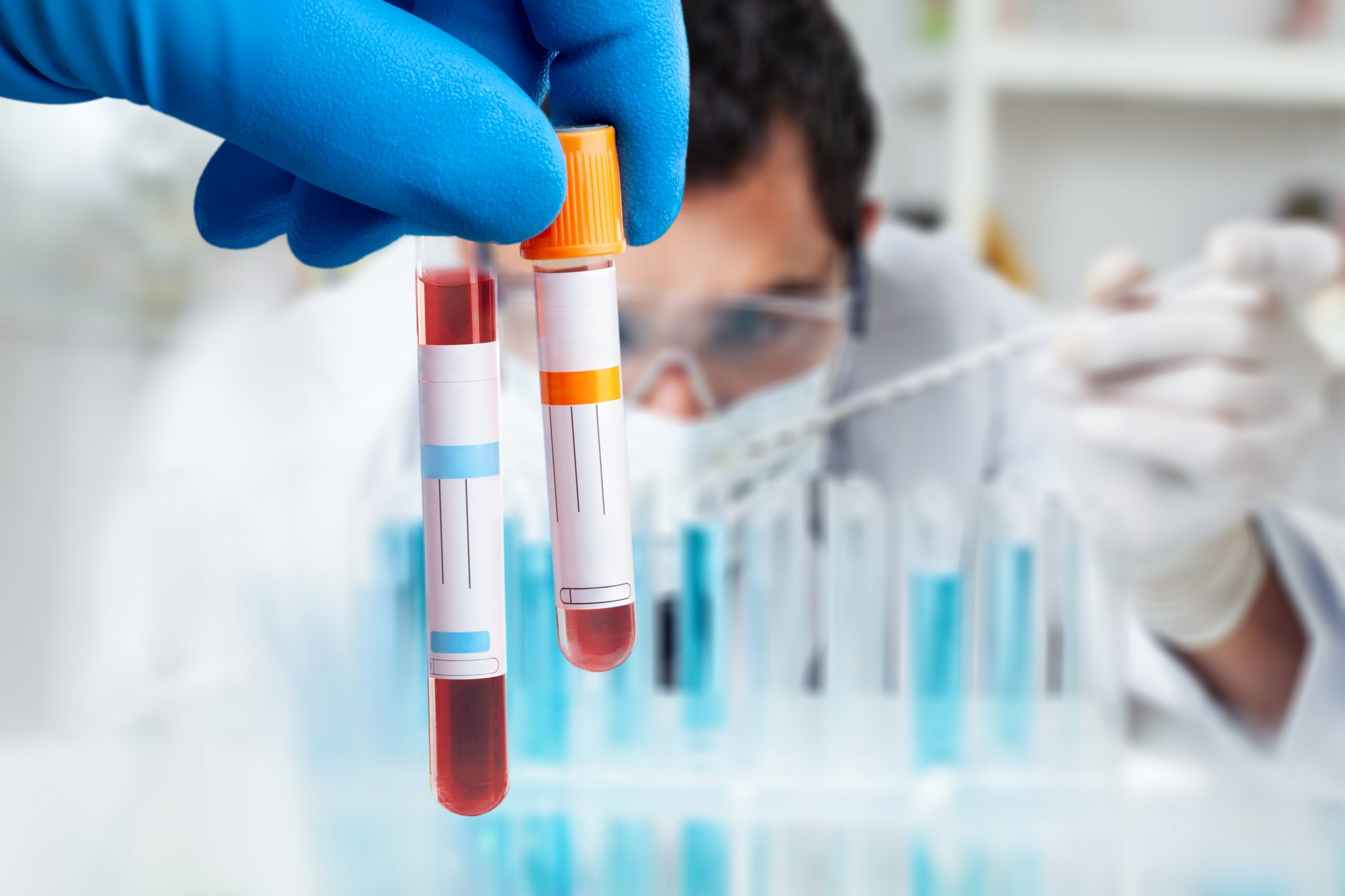 Labs@Lunchtime Series: “One Test, Right Result”: Improving the use of diagnostic tests